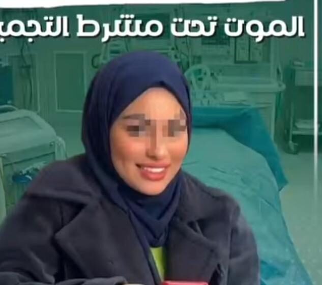 ضحية فتاة مشرط التجميل بمحافظة الاسكندريه الشابه آيه